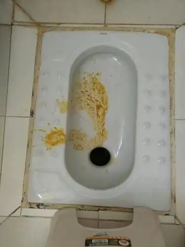 半个月的宝宝拉肚子怎么办