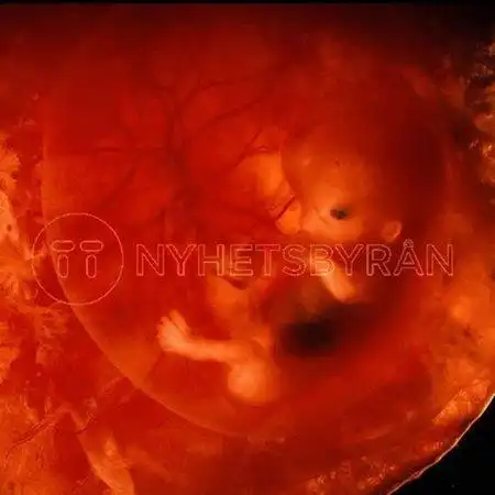 胎儿发育 从现在开始,准妈妈已经进入到孕8周,此时胎宝宝还处于胚胎期