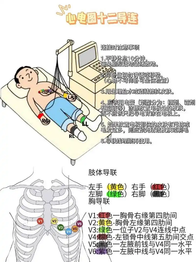 注意导联位置和颜色区分,记忆口诀:红黄绿棕黑紫,手和胸一样