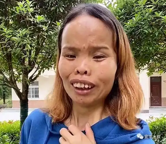 赣州女子"一丑成名",靠奇特长相圈粉百万,自信程度不输凤姐