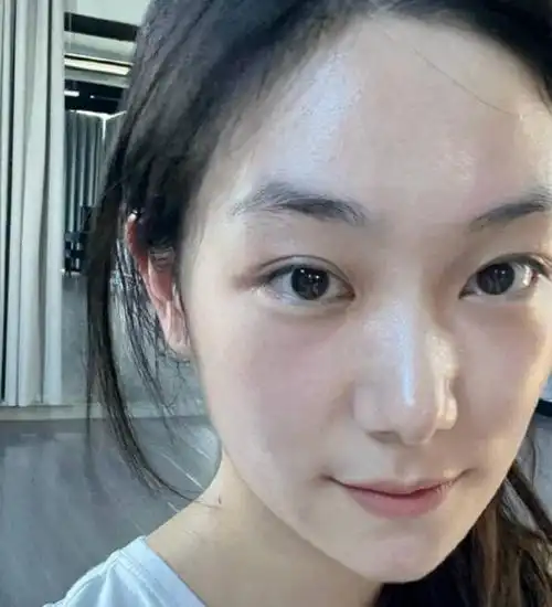 孙俪妹妹晒素颜近照,笑容甜美颜值高,现就读于北京电影学院