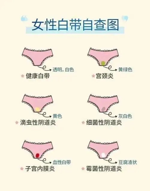 正常的女性阴道分泌物是无色,透明或者乳白色,没有任何气味.