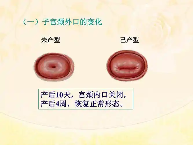 (一)子宫颈外口的变化 未产型 已产型 产后10天,宫颈内口关闭, 产后4