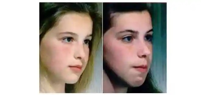 在日常生活中大伙儿可能见到过一些小孩,脸部没有什么表情,而且经常