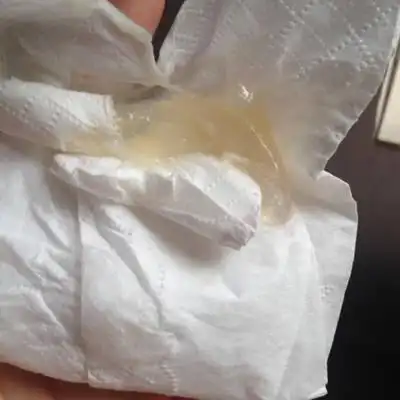 今早上流出一大坨分泌物这是什麼东西 孕40周加3了.