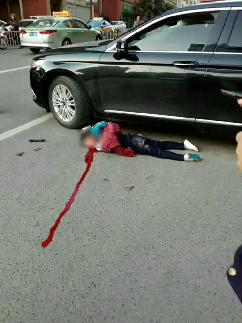 好惨哦,今日早晨巴中城一小学生被车撞现场不敢看!家长注意带孩子