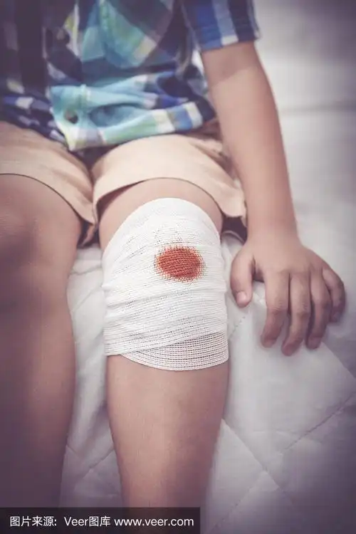孩子膝盖上的伤口用绷带包扎.复古的基调.