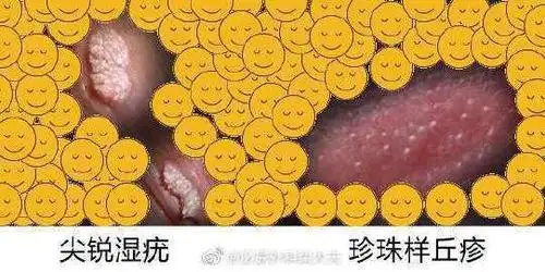 丁丁上起的小点点是啥?柒大夫的知. 来自泌尿外科柒大夫 - 微博