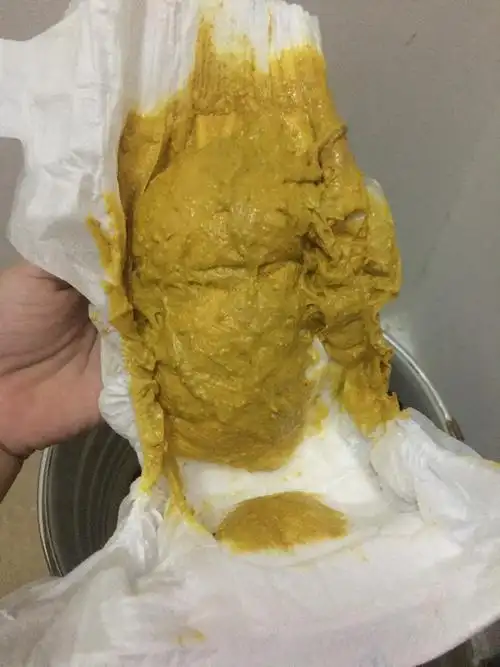 48天宝宝拉好多大便