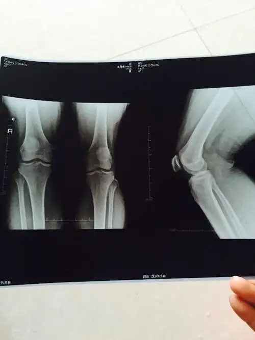 我弟弟腿部关节疼痛,在医院拍片了,医生也没说啥问题.请大家帮我看