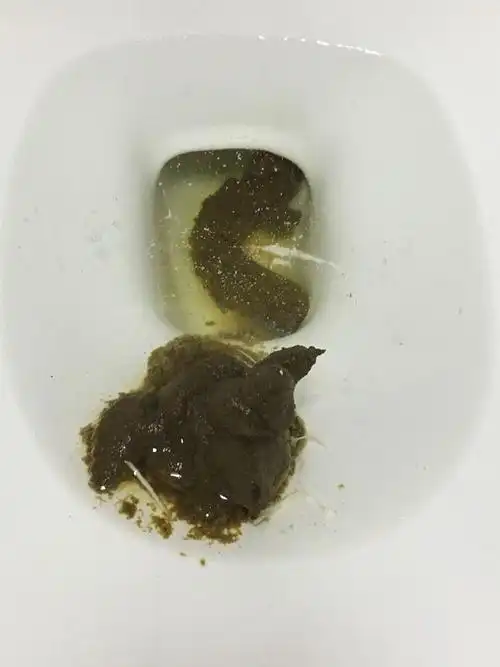在吃159换食第7天开始,大便便出像豆牙菜一样的
