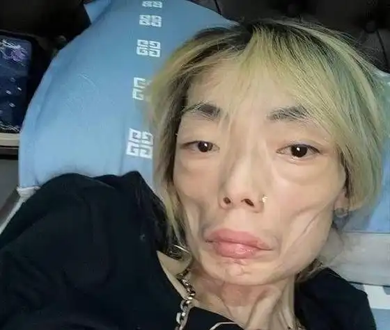 一样是瘦身减肥,这6位大牌明星有些人患肥胖症,有些人减肥瘦身过多只