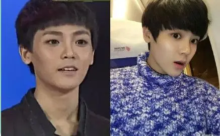 侯明昊整容前后照片对比 不仅撞脸鹿晗还撞脸李易峰