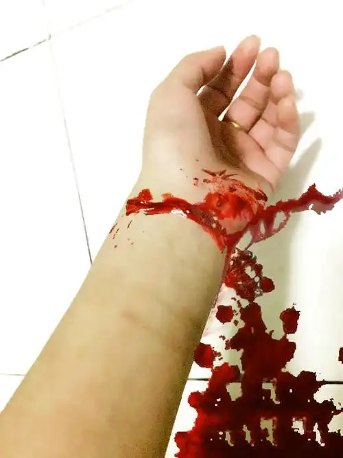 轻微自残照片真实照片  自残照片真实照片割手,刀割手流血清晰图片