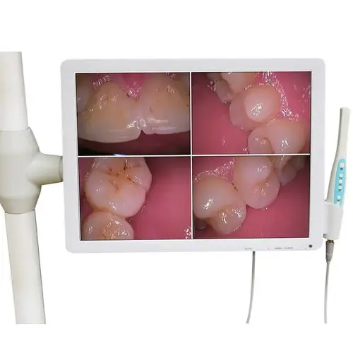 悦富500万像素口腔内窥镜一体机hd-b