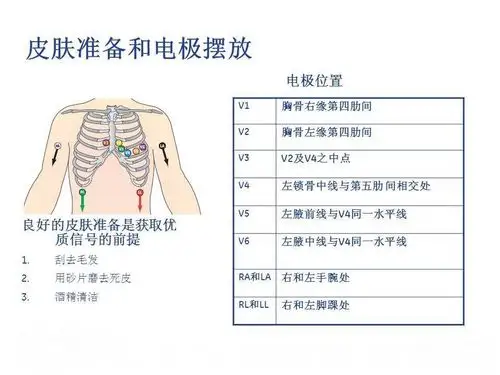 养老护理之心电图检查