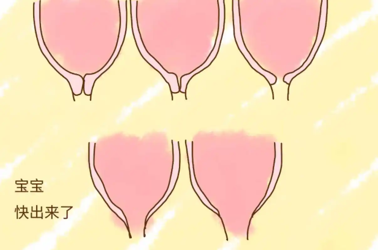 我们从什么时候开始监测宫颈管呢?