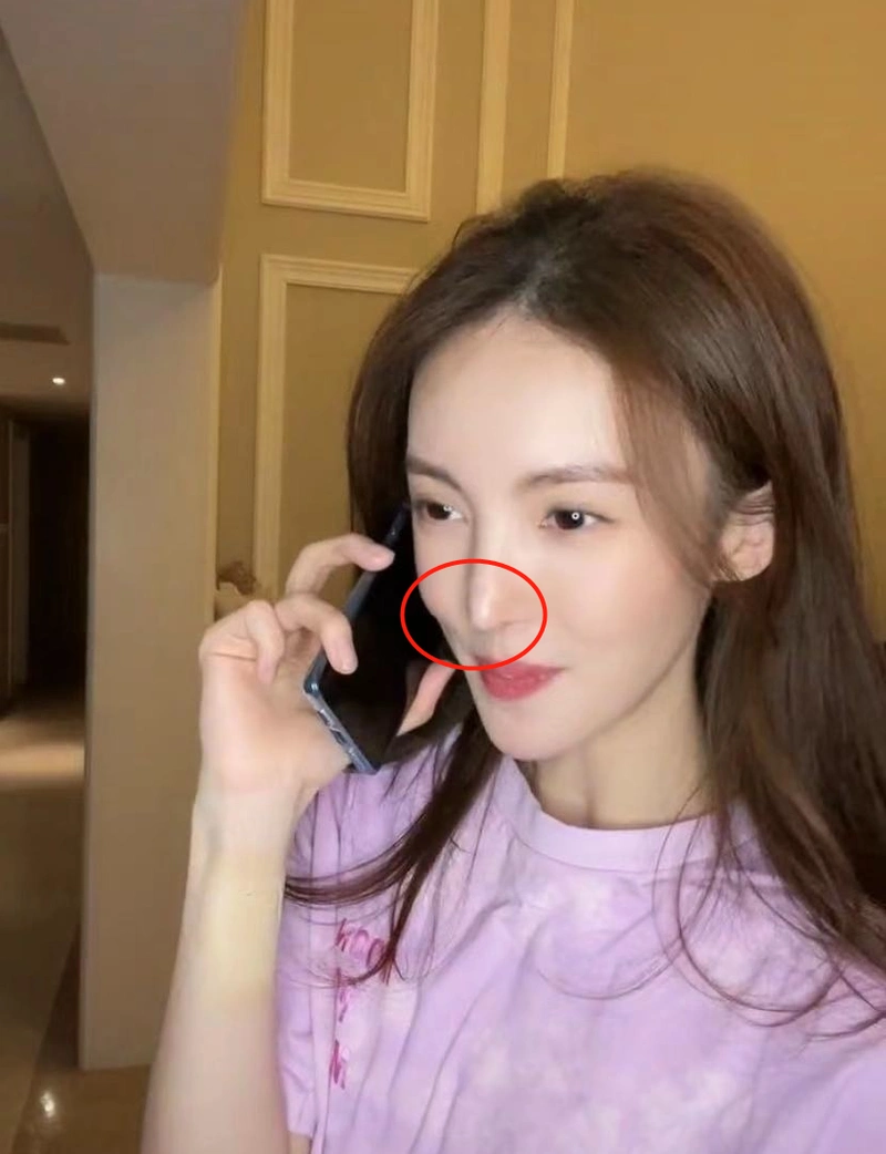 原创金晨的鼻子怎么了新照鼻头太尖被指无法呼吸再引网友整容质疑