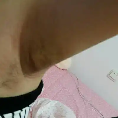 怀孕7个月,左右腋下都肿了怎麼回事,有宝妈有这种症状吗?急急急