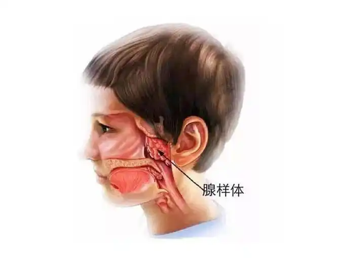 宝宝腺样体肥大怎么治疗 腺样体肥大是什么原因导致的 – topkid