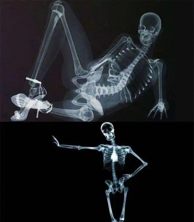 拍片子ct为何那么贵钱都被医院赚走了吗