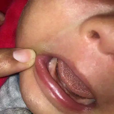 宝宝牙座上长了白白的东西是什麼