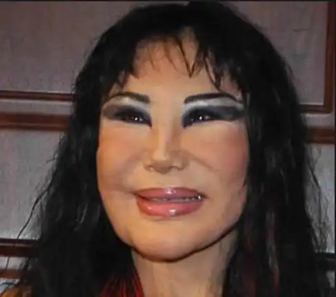 惨不忍睹整容失败后的超恐怖照片大汇集