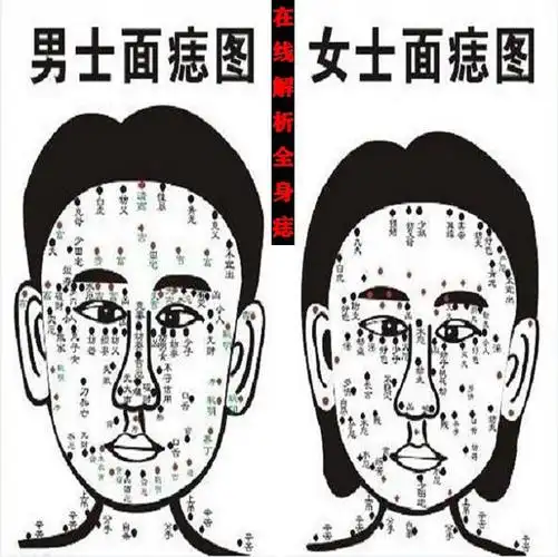 脸上痣相吉凶大全图解