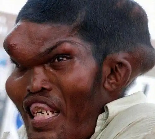 网络十大丑男照片(直击全球最丑10大男性,7个非洲,1个印度,竟然全都有