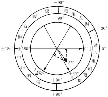 心电轴的测量方法及意义_挂云帆