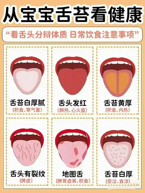 从宝宝舌苔看健康