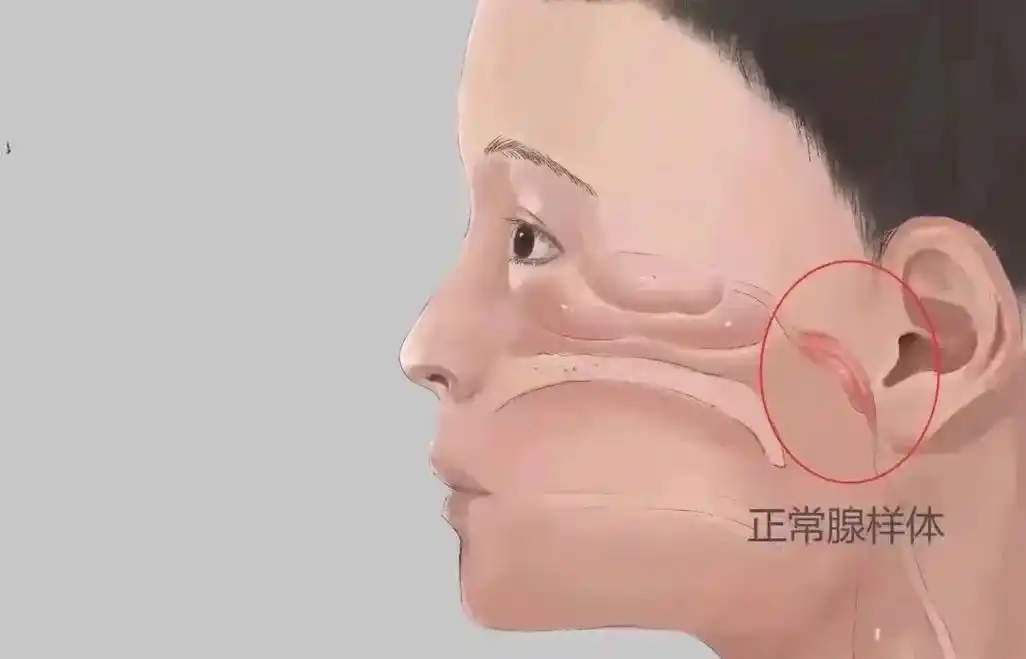 宝宝腺样体肥大,到底要不要割.宝宝孩子#腺样体肥大,到底要不 - 抖音