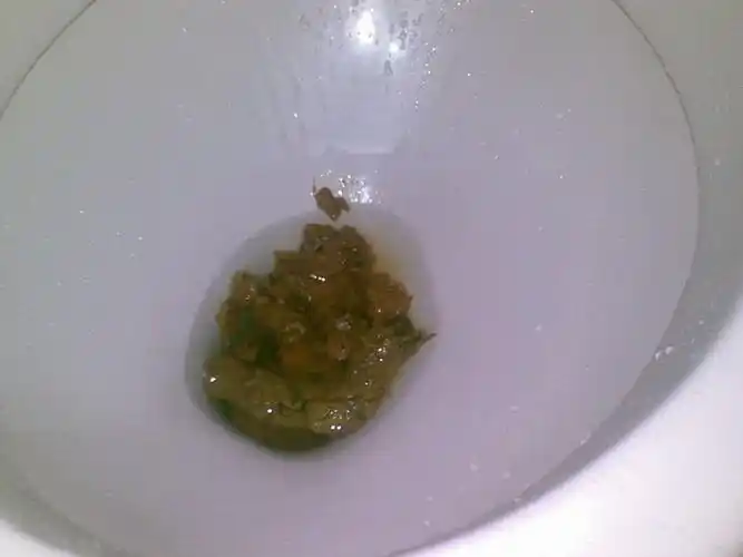 我5岁拉完屎后,屎在厕所里冲水冲不下去,怎么办?