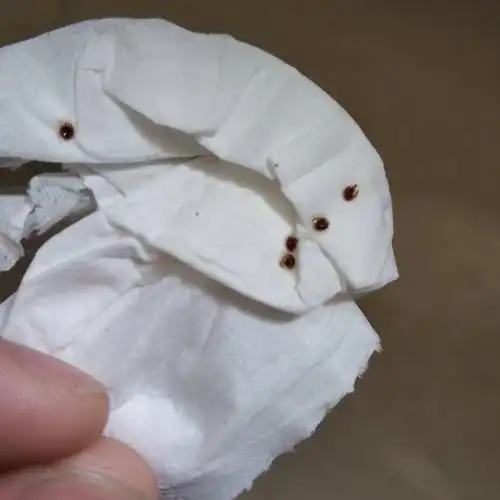 在被子上发现的请问这是什么卵.