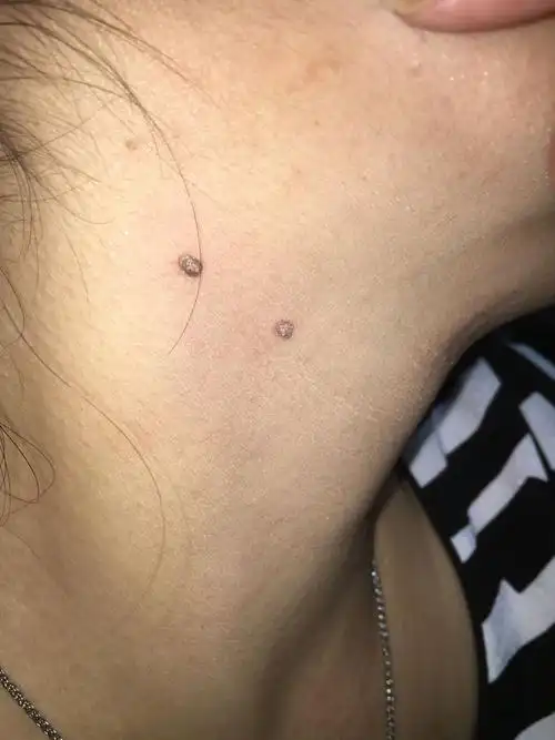 脖子上长了这个东西市什么?