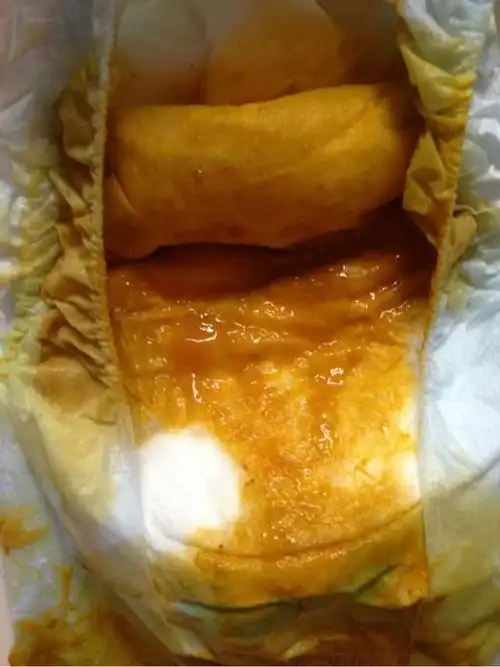 有点恶心,宝宝大便属于拉稀吗,纯母乳,正