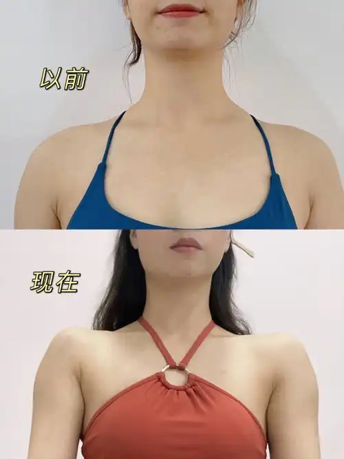 今天练肩给自己拍个对比图,练了半年从来没拍过,拍完震惊到自己,这是