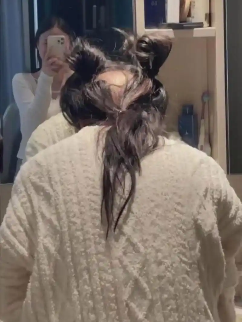 女生也会出现秃顶吗?我有点难以理解.