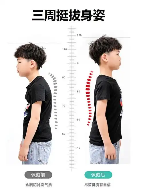 儿童驼背矫正器智能贝贝佳(热品库)