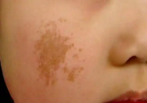 1,美白祛斑 脸部长斑发黄的女性,平时要搭配美白祛斑功效的护肤品使用