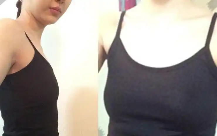 少女的隆胸经历做完之后感觉整个世界都冒着彩色泡泡