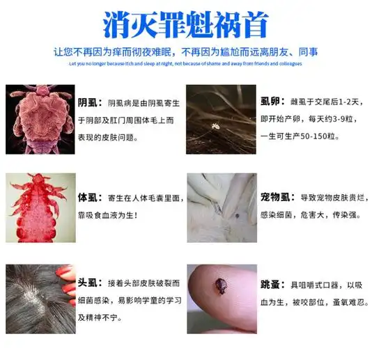 虱子一扫光成人头虱儿童去虱卵孕妇洗发水家用香波去除阴虱灭虱药