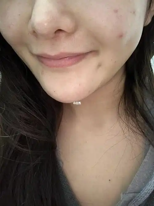 姐妹们这是梨涡吗