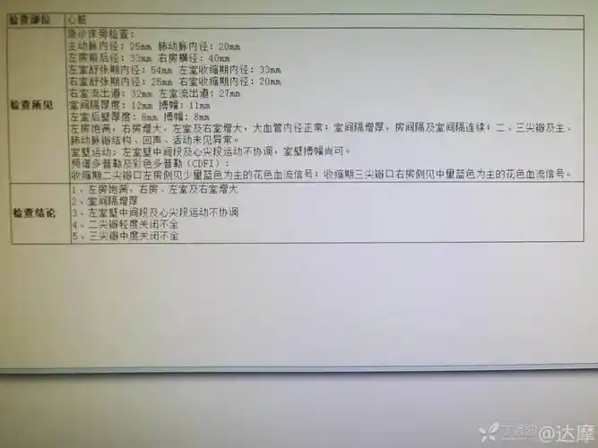 2 年多次心电图都报「心肌梗死」,但病人「安然无恙」,究竟是什么病?