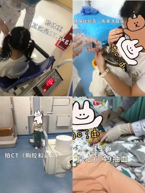 8215确诊腺样体肥大的症状:6月份在儿童医院确诊腺样体肥大90%.