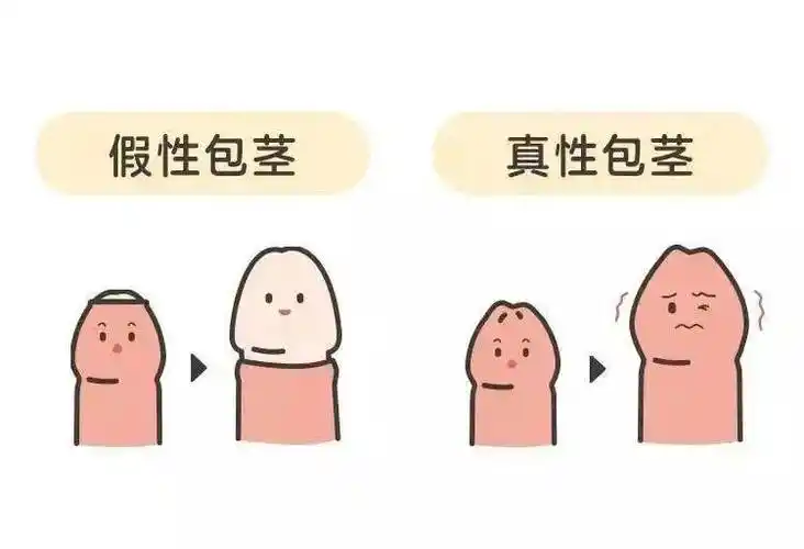 常见的主要有以下两种状态——特别是新生儿但很多宝宝的小鸡鸡不是