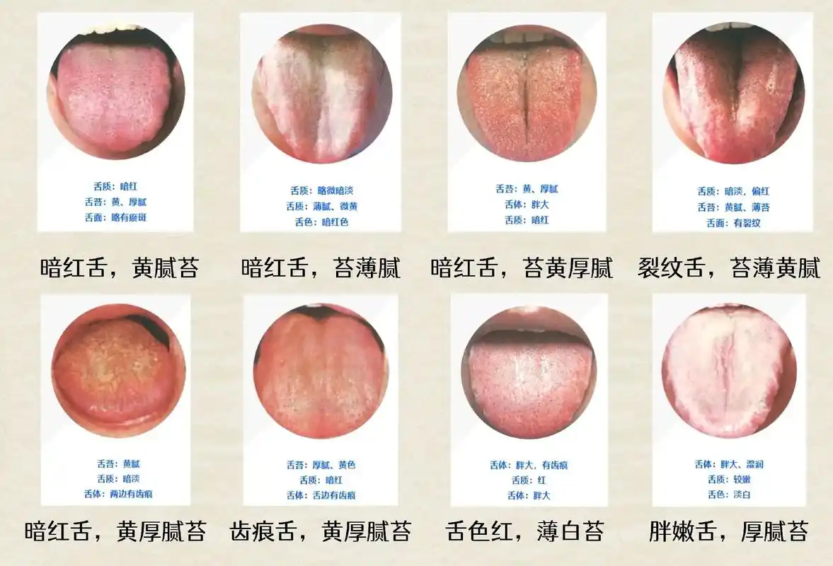 痰湿体质经典舌象#中医养生 #每天学点中医知识 - 抖音