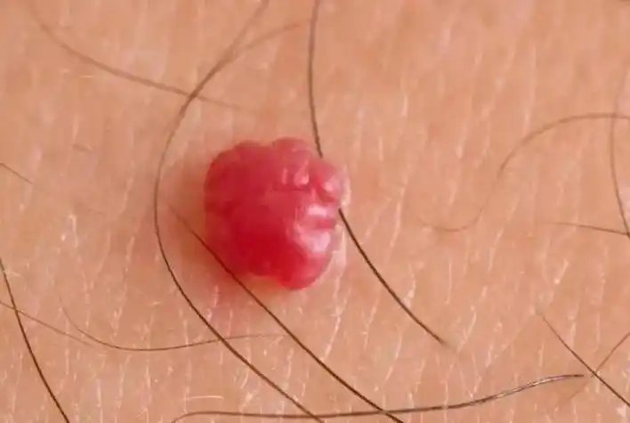 56岁大妈深夜入院,宫颈癌离世,医生:一把年纪还这样