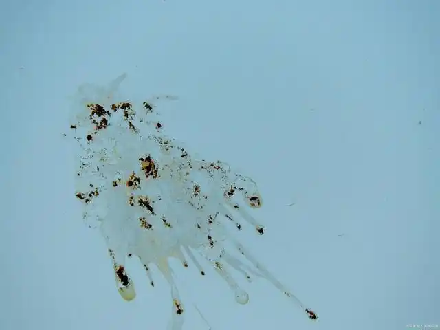 泌尿酸,这是一种白色晶体,当然可以也会因为食物的原因造成不同的颜色