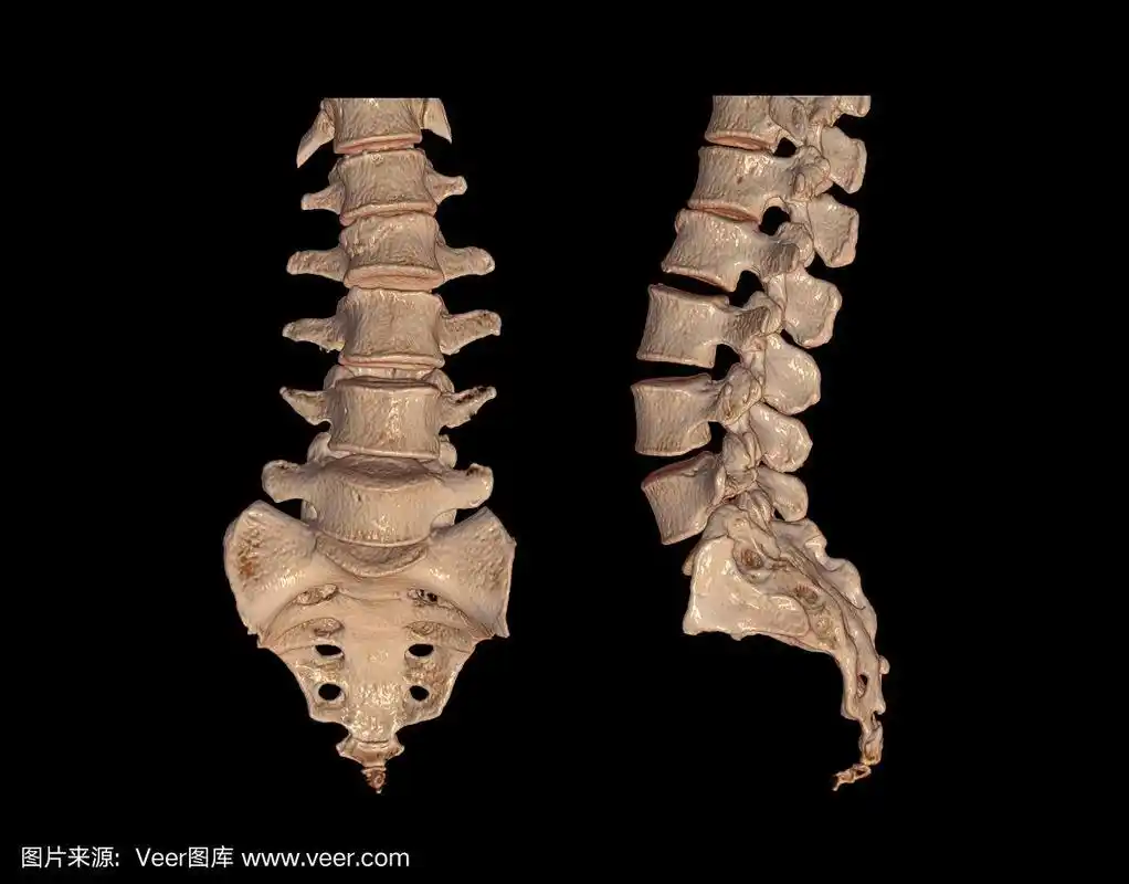 ct腰椎或l-s脊柱三维渲染图像前,后,侧位视图.